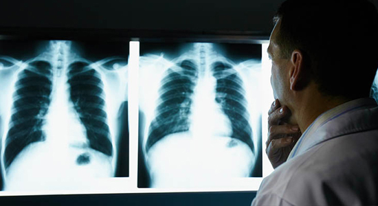 Occupational respiratory diseases: avoid biting the dust